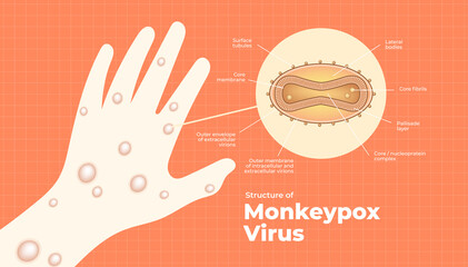 Structure of Monkeypox virus. Monkeypox virus banner.