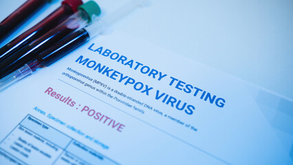 blood tube and data sheet on monkeypox test results in a laboratory.