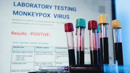 A screen that displays information about the monkeypox test results. and the blood tube in the lab...