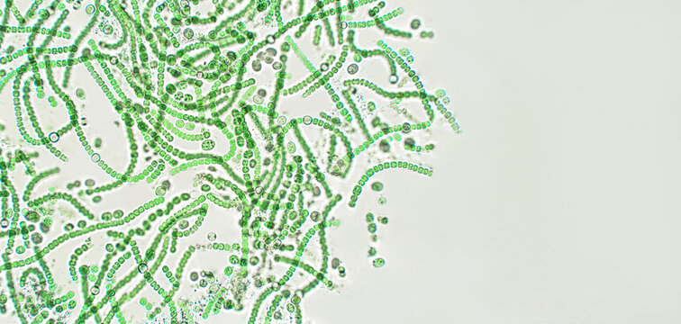 Nostoc sp. blue-green algae under microscopic view, cyanobacteria