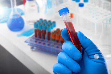 Blood sample of patient for test in laboratory. Doctor with Blood tube test in lab