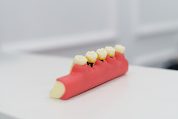 denture piece with molars and gum, didactic article for teaching, dental instrument in studio - obrazy, fototapety, plakaty