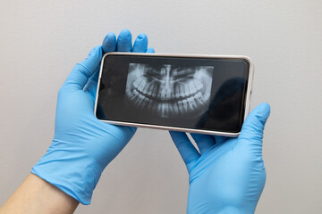 x-ray examination results on mobile device of a person's mouth, examining for dental treatment,...
