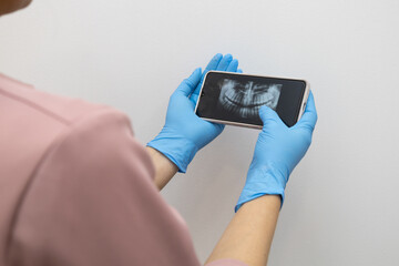 showing x-ray examination results on mobile device of a person's mouth, examining for dental treatment, technology and device in studio