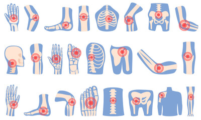 Arthritis icons set cartoon vector. Joint injury. Medical science