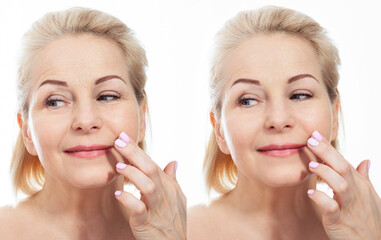 Middle age close up woman face before after cosmetic procedures. Skin care for wrinkled face....