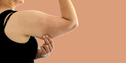 A young Asian woman grabbing skin on her upper arm with excess fat isolated on a white background....