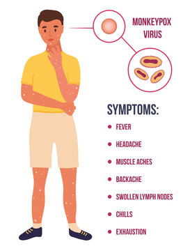 young caucasian man with many papule because of Monkey Pox virus outbreak pandemic.