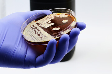 Probiotic yeasts isolated from a Kefir dairy dessert	