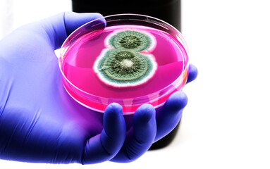 Isolated fungal colonies in the laboratory