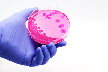 Hand of a doctor or researcher with a plate culture of pink microorganisms