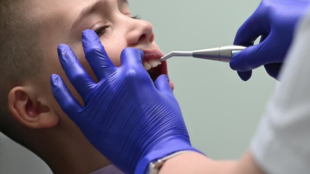 The dentist washes the teeth of the boy after the procedure of brushing his teeth close up