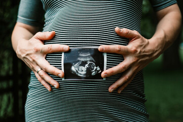 Pregnant belly with baby ultrasound 