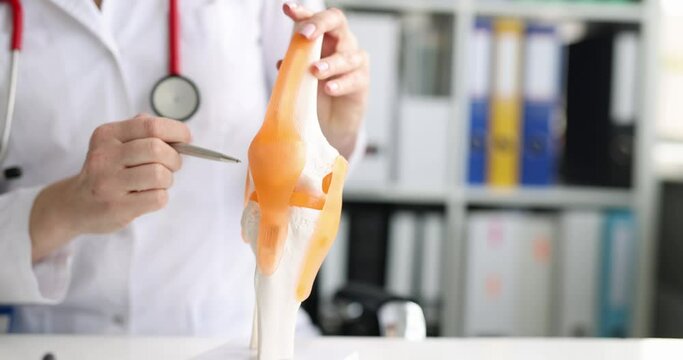 Doctor shows model of human artificial knee joint in medical office