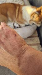 Tick on the hand against the background of a dog. The threat of life to an animal from a tick bite