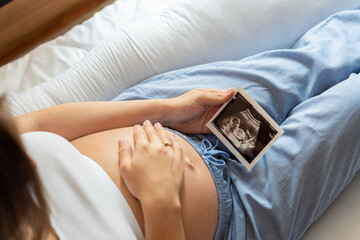 Ultrasound image pregnant baby photo. Woman holding ultrasound pregnancy picture. Pregnancy, medicine, pharmaceutics, health care and people concept. - obrazy, fototapety, plakaty