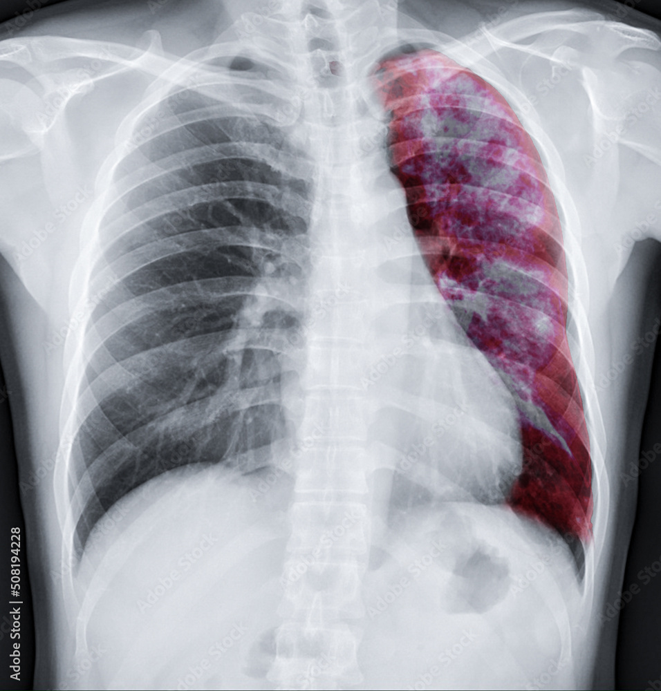 Aufkleber lung 3d rendering image.