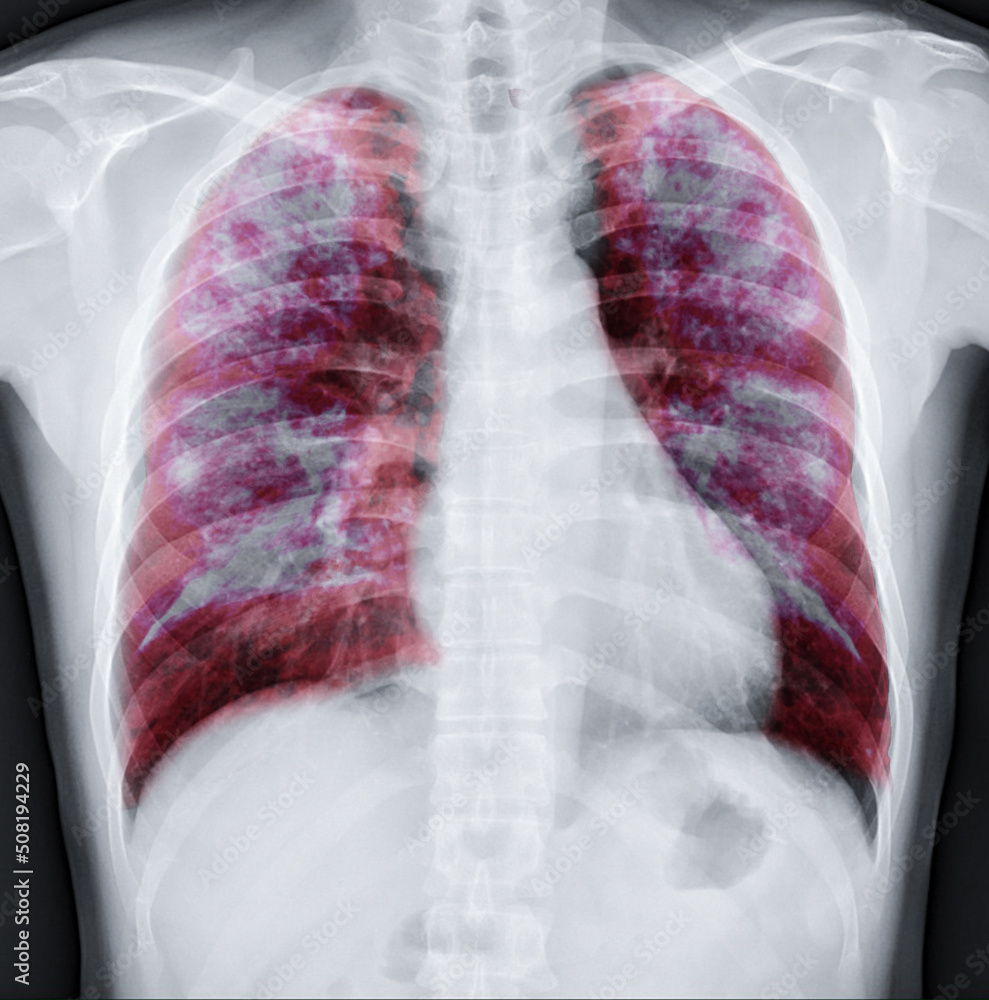 Poster lung 3d rendering image.