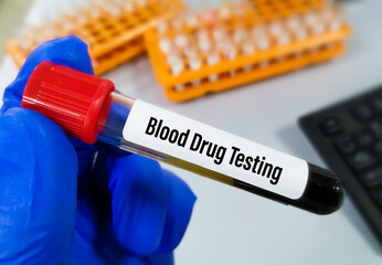 Blood sample for drug testing at medical laboratory for the detection of illegal drugs in human...