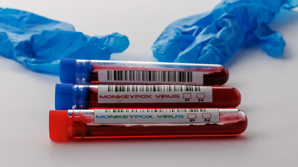flasks with blood tests for monkey pox virus positive and negative