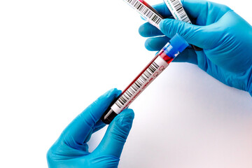 flasks with blood tests for monkey pox virus positive and negative