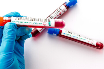 flasks with blood tests for monkey pox virus positive and negative