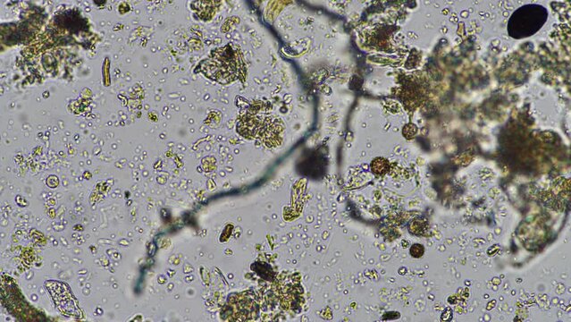 Fungal and fungi hyphae under the microscope in the soil and compost, in a soil biology and microorganism test in Australia.