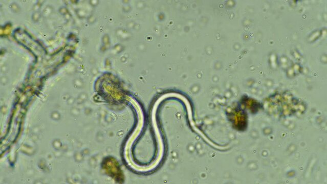 nematodes under the microscope in soil and compost