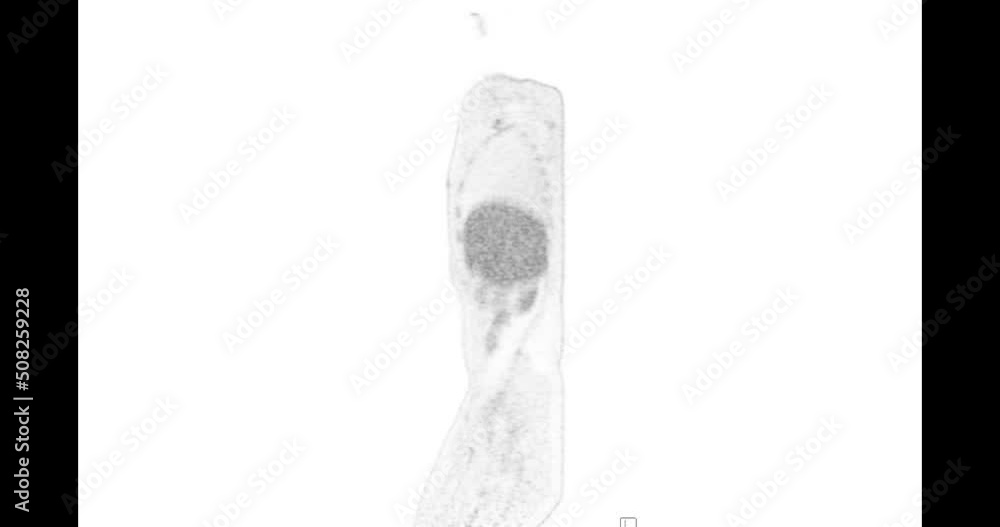 Poster pet ct ( positron emission tomography ) of whole human body 3d rendering image red color tone axial 