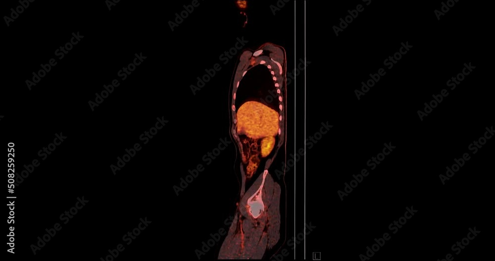 Poster pet ct ( positron emission tomography ) of whole human body 3d rendering image red color tone axial 