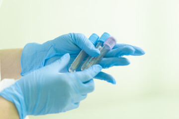 the nurse holds empty test tubes in two hands, prepares to take blood from the patient, the test tubes lie in the left hand at an angle