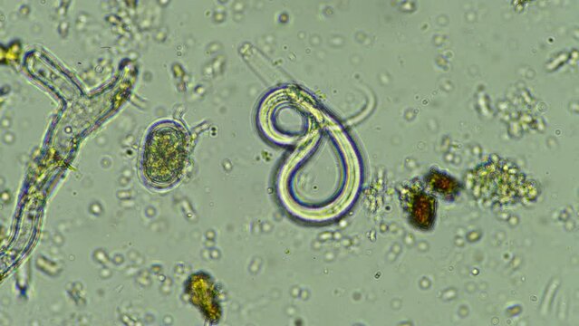 nematodes under the microscope in soil and compost