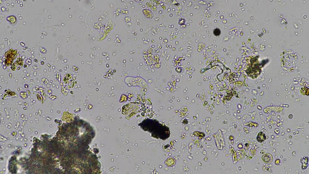 naked amoeba in compost and soil, under the microscope 