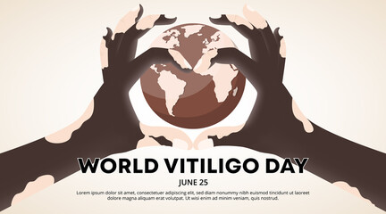 World vitiligo day background with love heart vitiligo hand