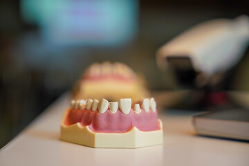 Model Human Tooth at the Dentist Clinic