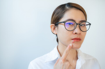 Asian woman pointing to Herpes labialis occur on her lower lip.