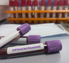 Blood sample for Graft versus host disease(GvHD). condition that might occur after an allogeneic...
