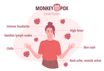 Monkey pox outbreak. Infographics of virus symptoms in humans. Vector illustration for informing people about an infectious disease