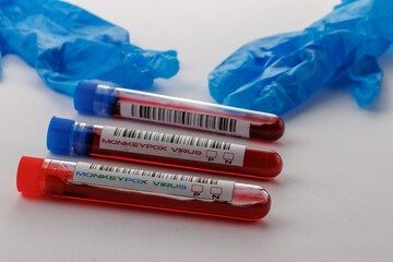 flasks with blood tests for monkey pox virus positive and negative