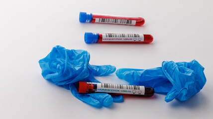flasks with blood tests for monkey pox virus positive and negative