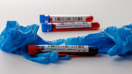 flasks with blood tests for monkey pox virus positive and negative
