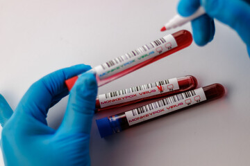 flasks with blood tests for monkey pox virus positive and negative
