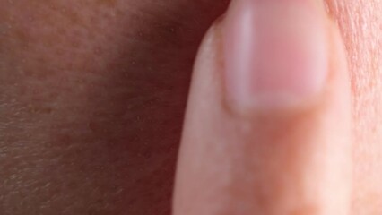 Human skin. Close up. common skin diseases include: Acne, blocked skin follicles that lead to oil. Atopic dermatitis, dry, itchy skin that leads to swelling, cracking or scaliness. - Powered by Adobe