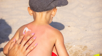 Mom puts sunscreen on Sin's back in the shape of a heart.