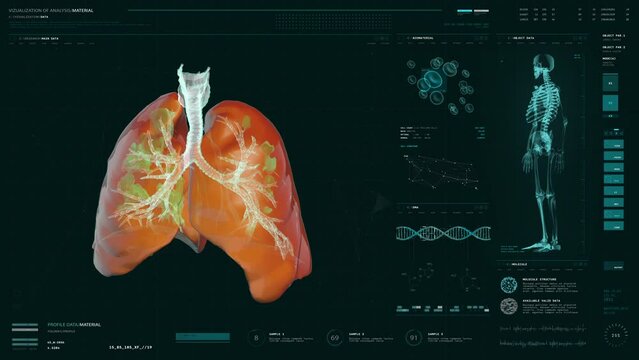 Human Patient Respiratory System Examination Via X-ray Screening Device. Lung Cancer Disease Detection During Respiratory System Examination. Respiratory System Examination At A Medical Laboratory.