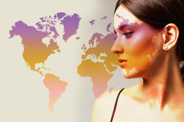Woman with vitiligo side view on world map. International and World Vitiligo Day. Toning purple and...