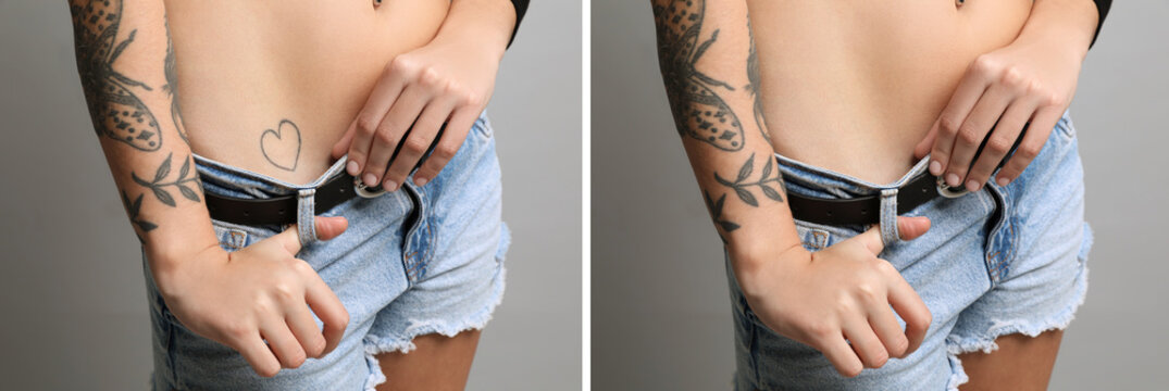 Woman before and after laser tattoo removal procedure on light grey background, closeup. Collage with photos, banner design