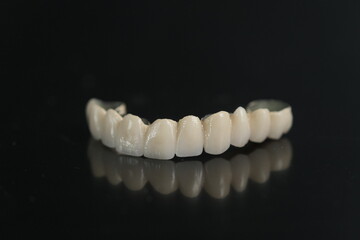 Dental ceramic bridge on isolated wite background. Metal free ceramic dental crowns.  Closeup ceramic to dental implants in laboratory.