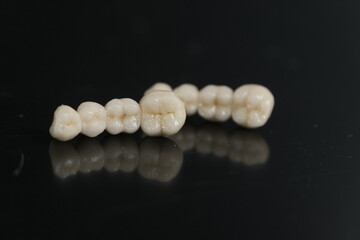 Dental ceramic bridge on isolated wite background. Metal free ceramic dental crowns.  Closeup ceramic to dental implants in laboratory.