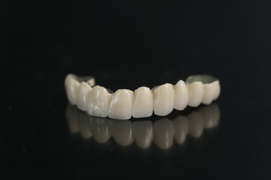 Dental ceramic bridge on isolated wite background. Metal free ceramic dental crowns.  Closeup ceramic to dental implants in laboratory.